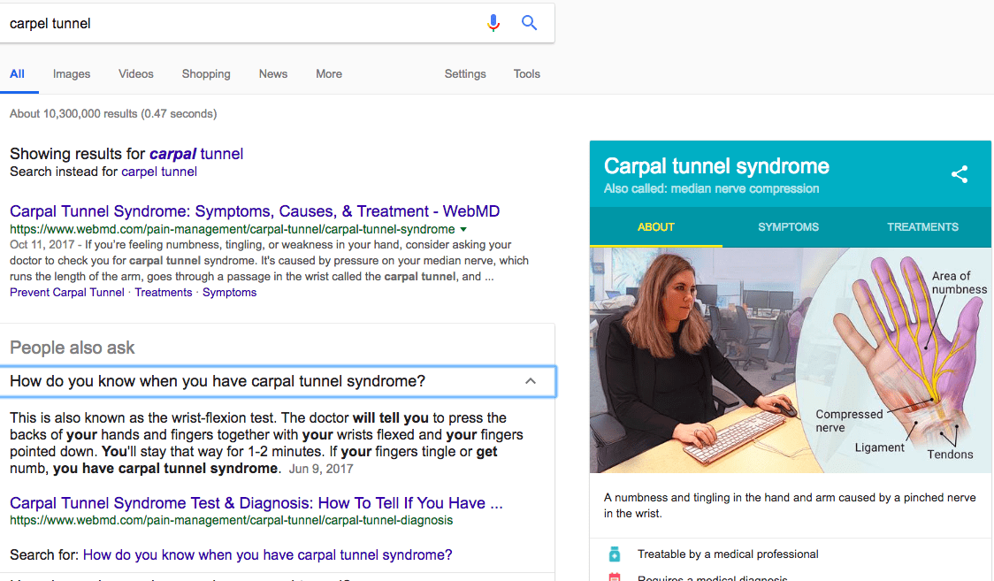 carpal tunnel featured snippet